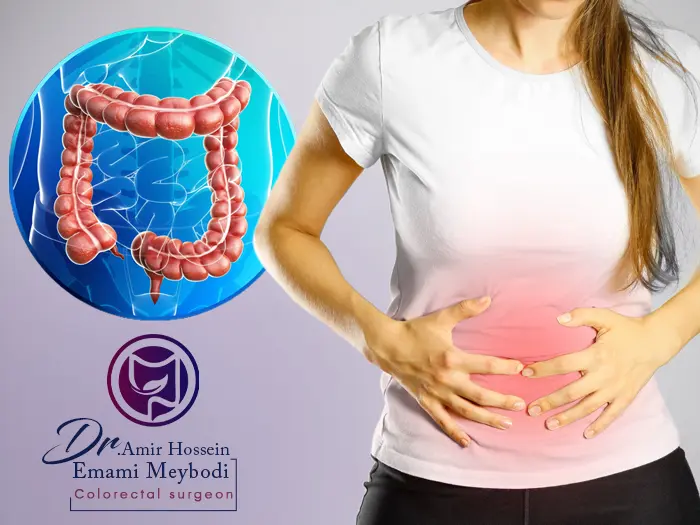 آندومتریوز روده