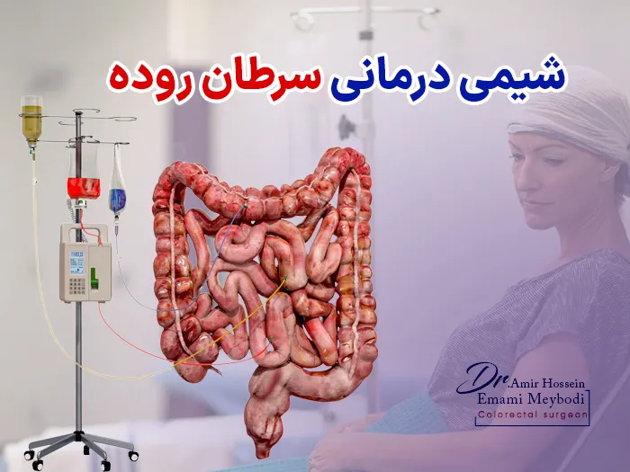 شیمی درمانی سرطان روده بزرگ