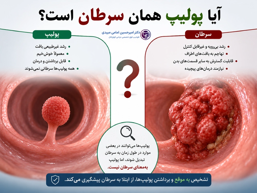 آیا پولیپ روده سرطان است