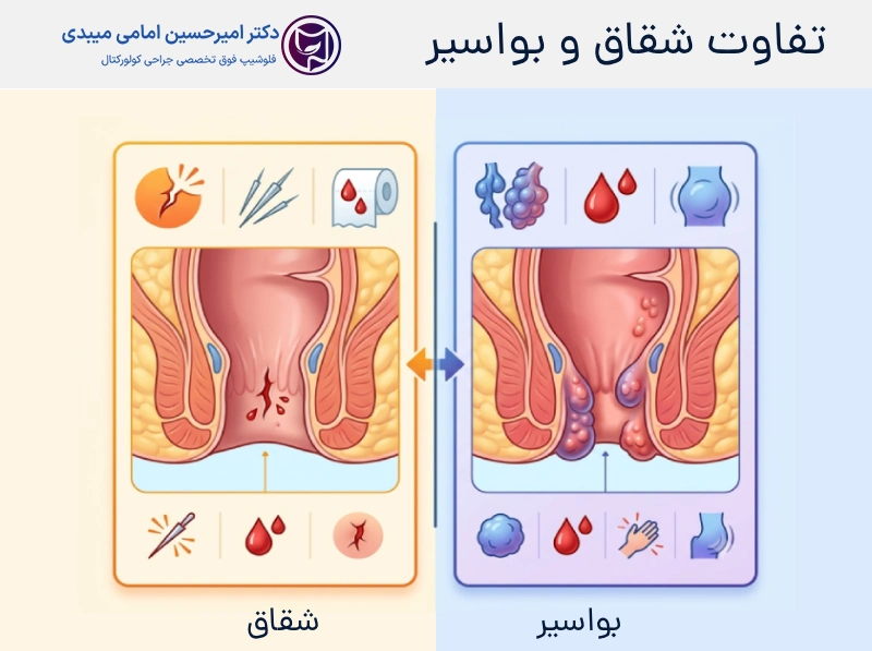 تفاوت شقاق و بواسیر